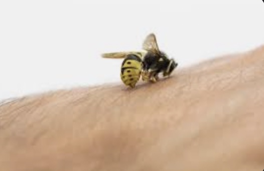 The Dangers of Bee Stings What You Need to Know