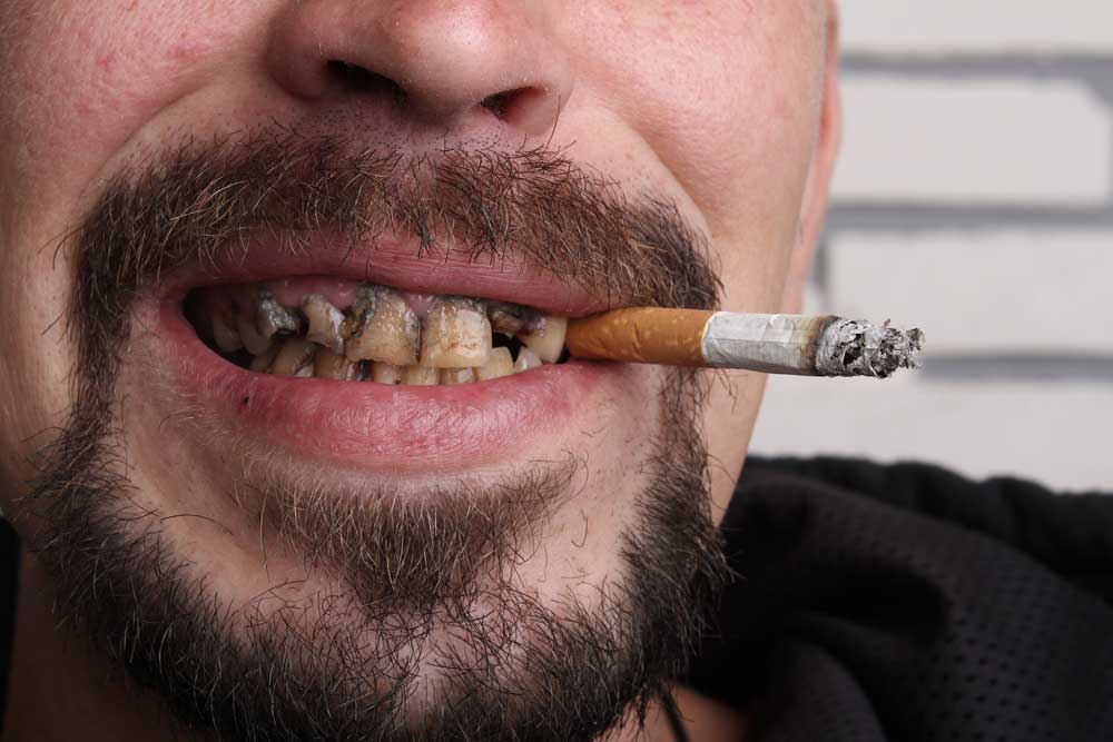 How does smoking affect the teeth?