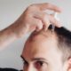 Using Minoxidil For Receding Hairline: What To Know?